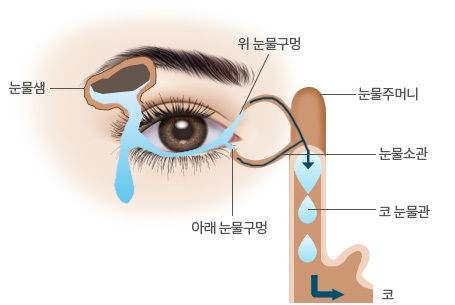 소아눈물길/눈썹찔림