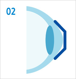 드림렌즈란?