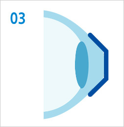 드림렌즈란?