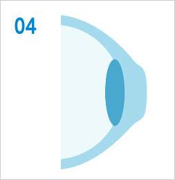 드림렌즈란?