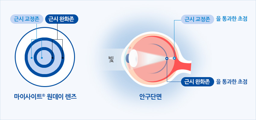 마이사이트 원데이 렌즈란?