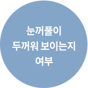 위눈꺼풀성형술