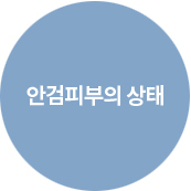 위눈꺼풀성형술